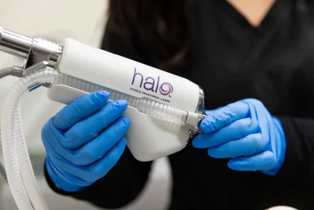 Sciton Halo Laser Treatments in Albany OR